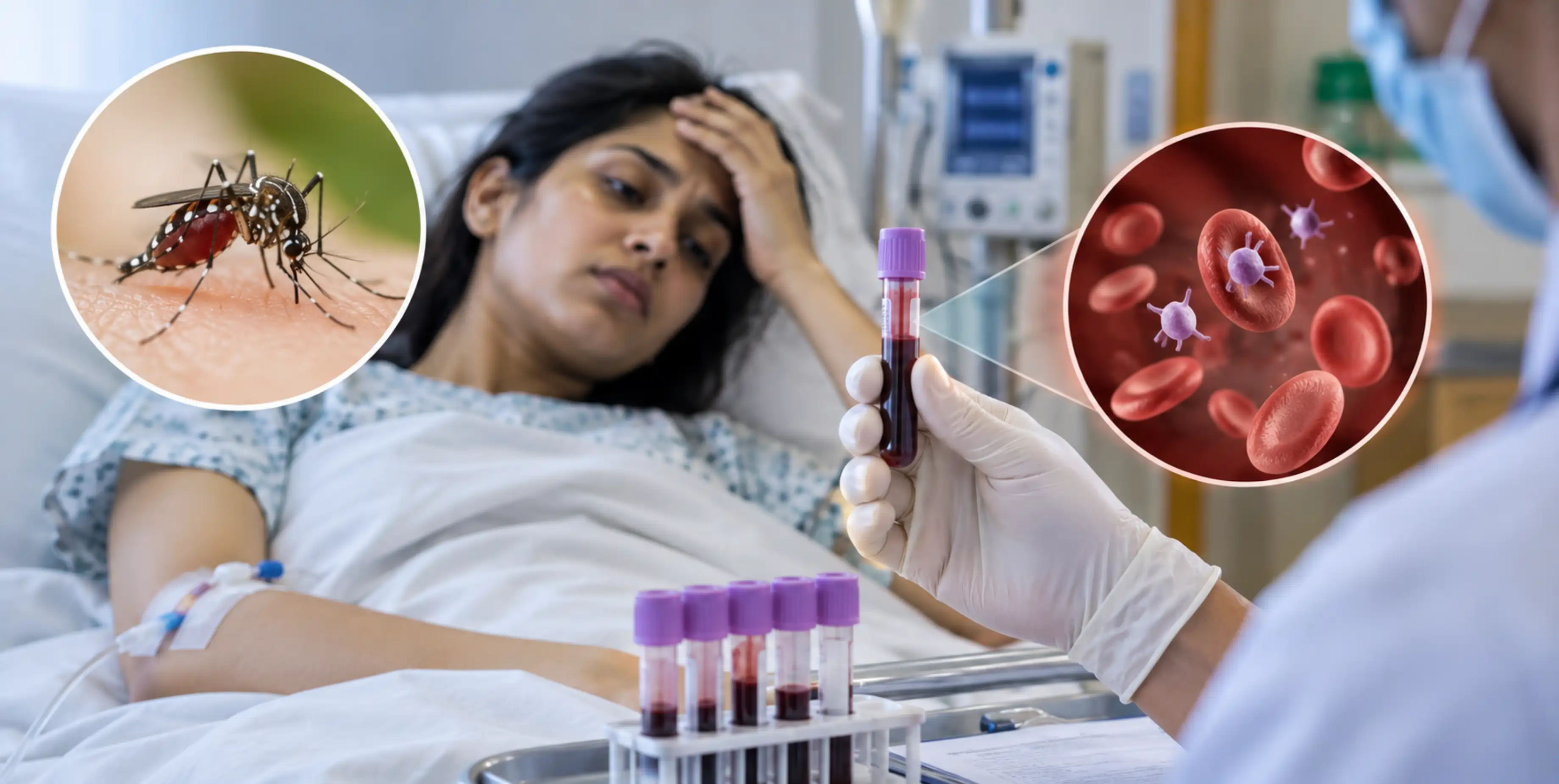 Dengue platelet count and warning signs requiring hospitalisation